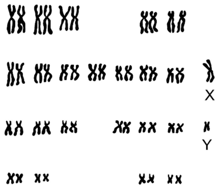 Karyogramm mit Chromosomenpaaren und den Geschlechtschromosomen X und Y
